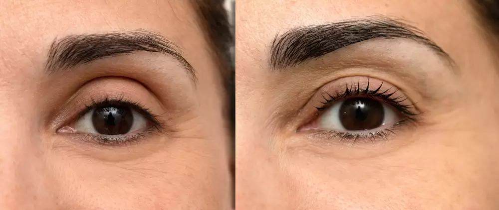 Eyelash,Lamination.,Woman,Eye,Before,And,After,Treatment,Lash,Lift.